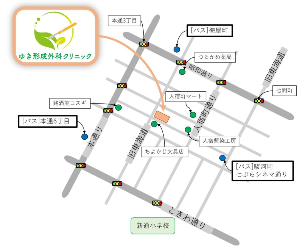 静岡市のゆき形成外科クリニックの位置を説明するための地図。