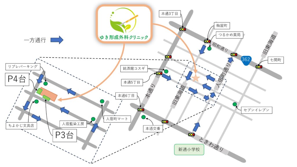 静岡市のゆき形成外科クリニックの位置を説明するための地図。